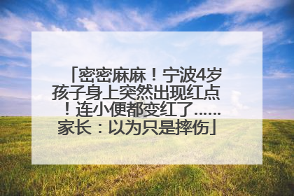 密密麻麻！宁波4岁孩子身上突然出现红点！连小便都变红了……家长：以为只是摔伤